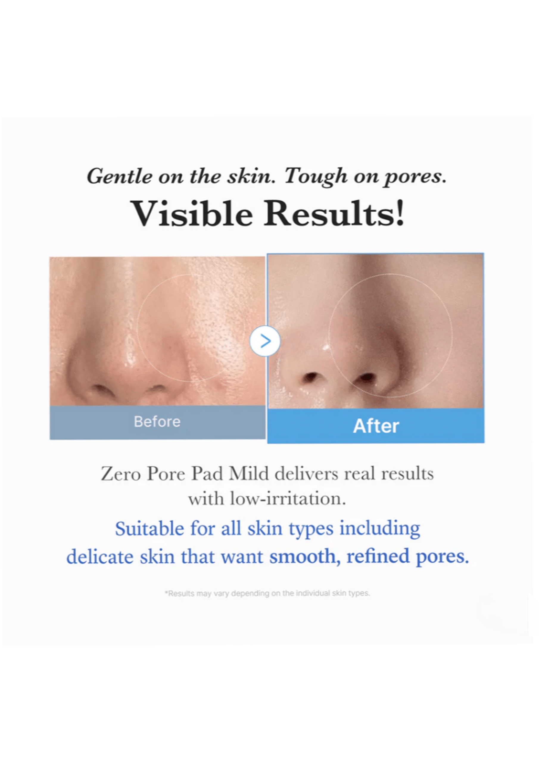 Medicube Zero Pore Pad Mild - Image 2